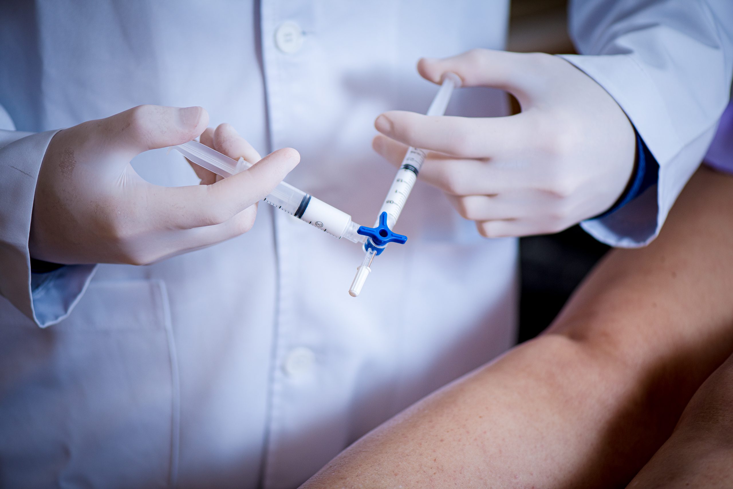 Escleroterapia com Espuma